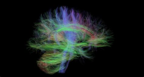 NEW Brain Imaging Study | The Dunedin Study - Dunedin Multidisciplinary 