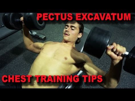Pectus Excavatum Bodybuilding Chest Training Tips Youtube