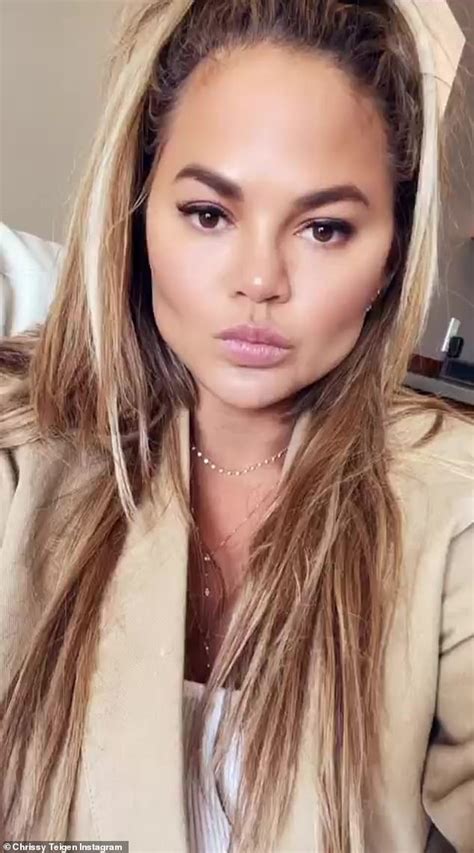 Chrissy Teigen Admits She Had Fat Removed From Her Face In Candid Chat