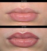 Lips Permanent Makeup Images
