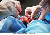 Heart Surgery Doctor Photos