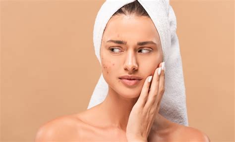 Clearing Up Acne Steps To Get Rid Of Acne Fast Wellness Observer