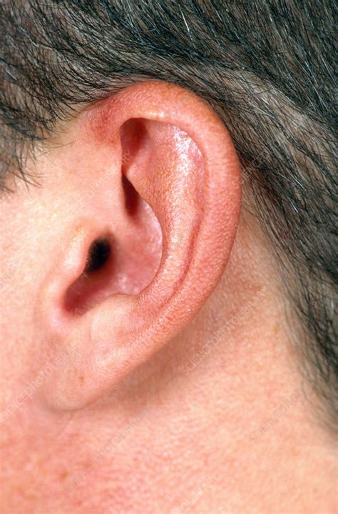 Mans Ear Stock Image C0034366 Science Photo Library
