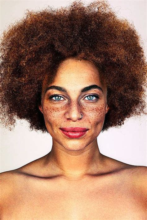 These Photos Of Freckles Will Make You Love Your Spots Even More Face
