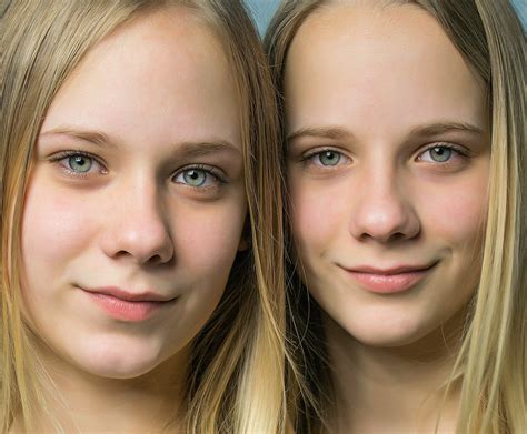 ¿por qué unos gemelos se parecen más que otros tipos de embarazos múltiples