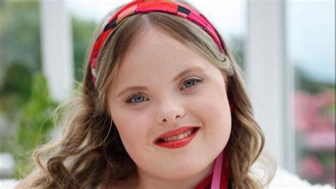 Welsh Model With Downs Syndrome Signed By Top Agency Ents And Arts
