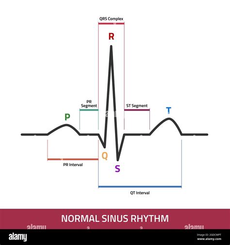 Electrocardiogram Showing Normal Sinus Rhythm Stock Vector Images Alamy