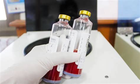 Blood Culture Test Reports And Insights Suburban Diagnostics