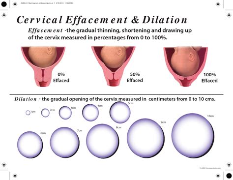 During labor, your cervix will stretch from 0cm to during a vaginal exam, cervix dilation is measured by how many finger widths fit into the opening of. Cervical Effacement Dilation | Cervical effacement, Cervix ...