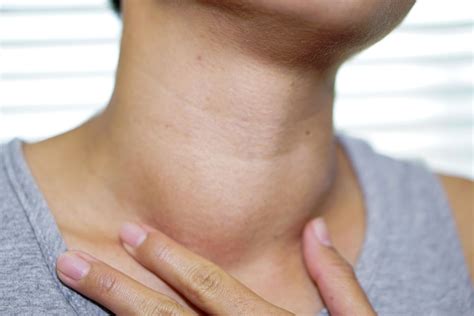 What Are Thyroid Cysts Everything One Should Know To Be Safe