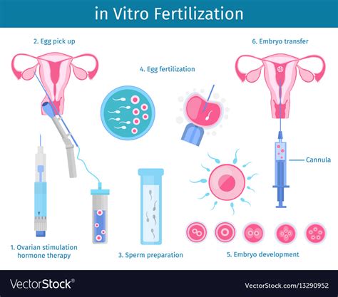 In Vitro Fertilization Process Concept Royalty Free Vector