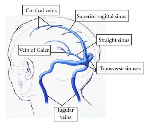 The Major Venous Sinuses And Their Tributaries Download Scientific