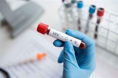 Mengapa Tes HIV Penting untuk Kesehatan Anda?