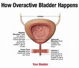 Images of Medicine To Control Overactive Bladder