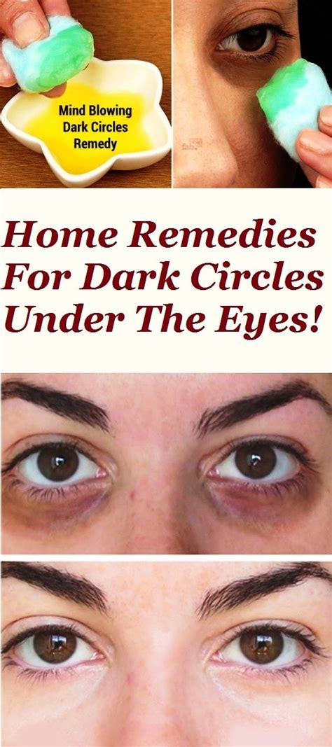 Home Remedies For Dark Circles Under The Eyes Health Capsules