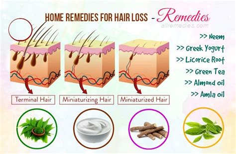 70 Best Natural Home Remedies For Hair Loss In Males And Females