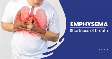 Emphysema What Is It Causes Symptoms And More
