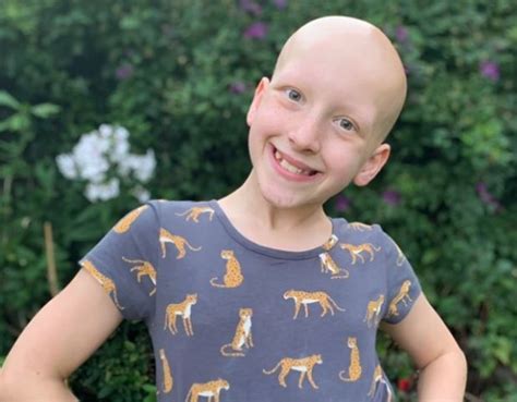 Wirral Schoolgirl Syndey Raising Awareness For Alopecia Uk In An Eye