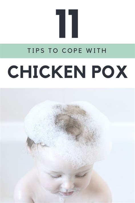 Top Tips On How To Cope With Chicken Pox K Elizabeth