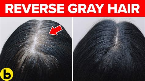 11 Natural Ways To Help Reverse Premature Gray Hair Youtube
