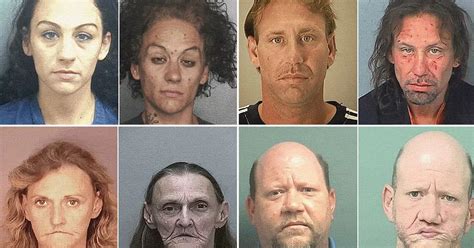 Faces Of Meth Horrific Transformation Of Fresh Faced Adults Into My Xxx Hot Girl