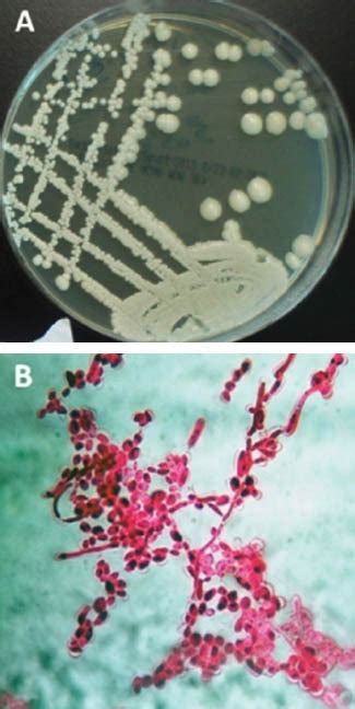 Growth Of Candida Albicans On Sabouraud Dextrose Agar A Colonies With
