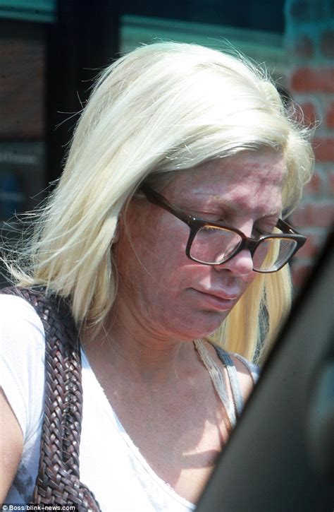 Tori Spelling Leaves Spa With A Red Face After Undergoing Three