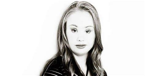 Madeline Stuart Model With Down Syndrome