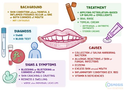 Angular Cheilitis What Is It Causes Treatment And More Osmosis