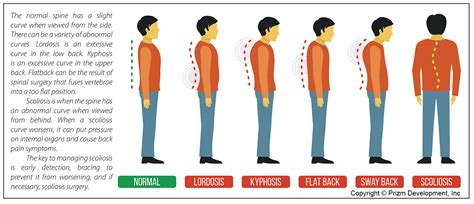 Flatback Syndrome Spine Center Network