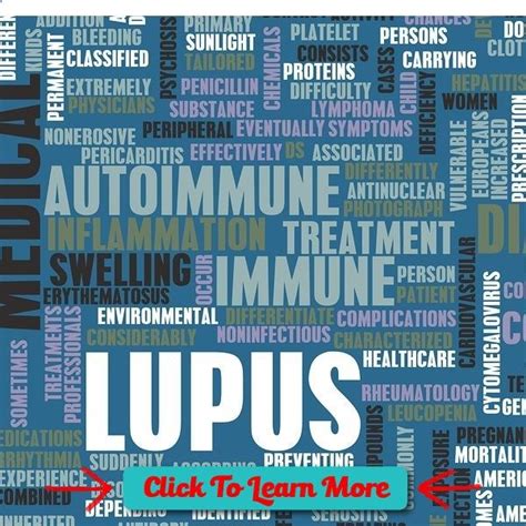Lupus Is An Autoimmune Condition That Causes Severe Muscle And Joint