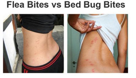 How long do bed bug bite last? How Can A Flea Infestation Affect Your Health?