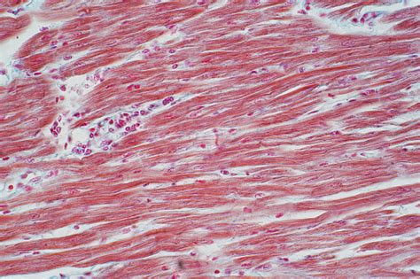 Histologi Otot Jantung Manusia Di Bawah Pandangan Mikroskop Untuk