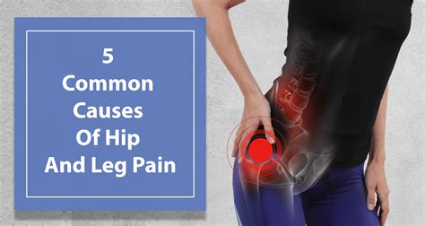 What Causes Hip And Leg Pain Cares Healthy