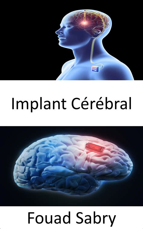 Implant Cérébral La Recherche Qui Soutient Neuralink La Puce