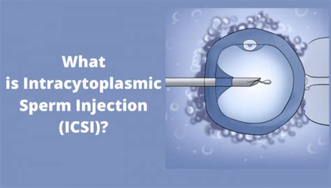 What Is Intracytoplasmic Sperm Injection Icsi