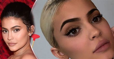 Kylie Jenner Returns To Cosmetic Procedures After Having Her Lip