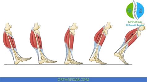 Gait Cycle Phases Biomechanics Orthofixar