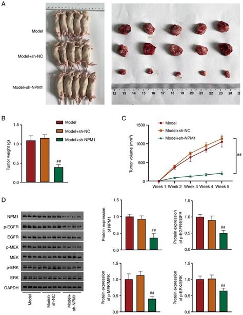 NPM1 Silencing Inhibits Lung Adenocarcinoma Tumor Growth By Restraining