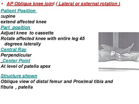 Lecture 16 Knee Joint Basic Projections Ap Lateral