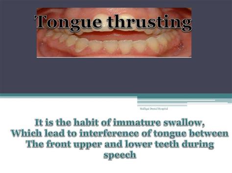 Tongue Thrusting Habit Clinical