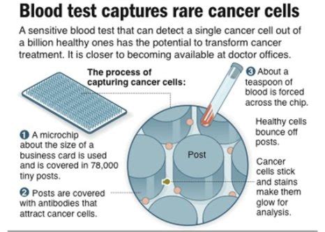 A new method reported today in nature communications brings researchers a step closer to that goal. Cancer Blood Test Might Soon Be a Reality | MyDocHub Blog ...