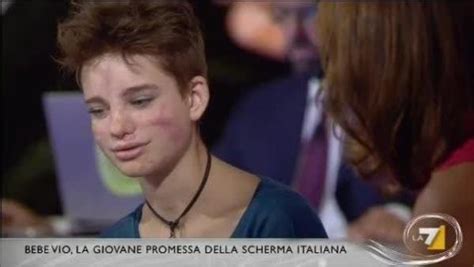È un'atleta paralimpica e una donna incredibile. Bebe Vio: storia, malattia, età e viso. Cos'ha avuto l ...