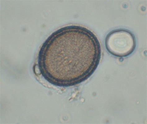 Taenia Tapeworms Troccap
