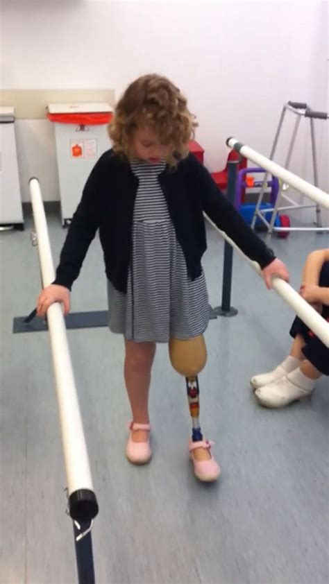 Unstoppable Year Old Amputee Says Nothing Is Holding Her Back As She