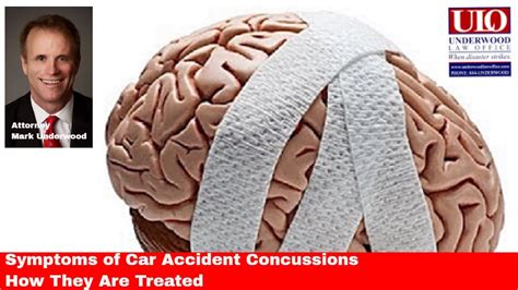 Symptoms Of Car Accident Concussions And How They Are Treated Youtube