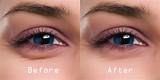 Home Remedies For Eye Bags Removal Pictures