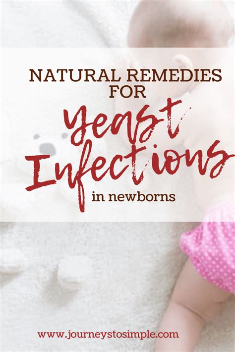 Home Remedies To Treat Yeast Infections In Your Baby Treat Yeast