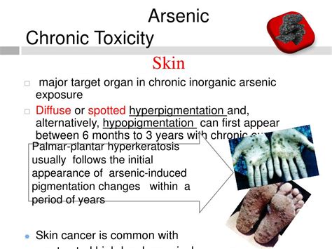 Ppt Lead And Arsenic Toxicity Powerpoint Presentation Free Download