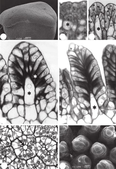 Development Of The Passiflora Elegans Stigma A Young Stigma Under